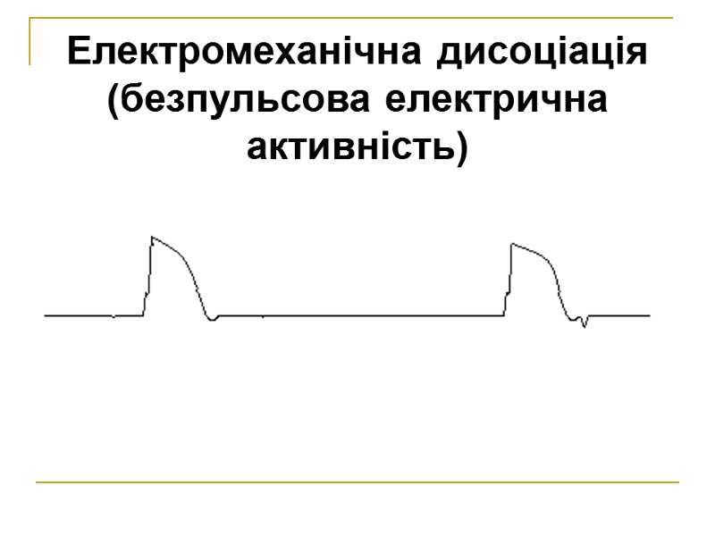 Електромеханічна дисоціація (безпульсова електрична активність)